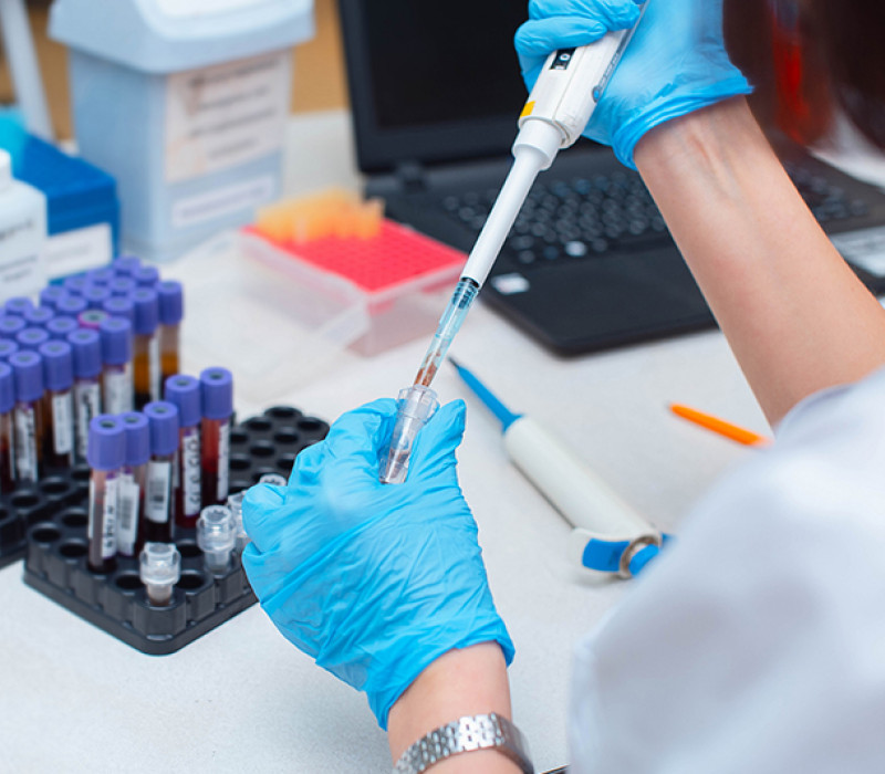 Prenatalni test - Sve što treba da znate