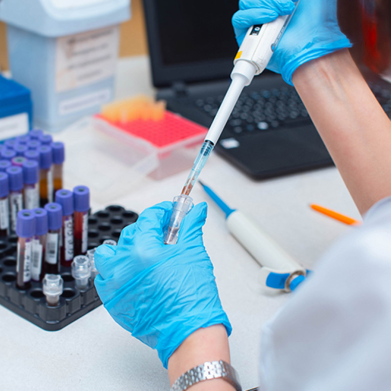 Prenatalni test - Sve što treba da znate