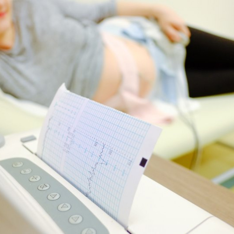Šta je CTG pregled i kada se radi tokom trudnoće?